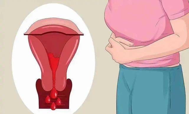 不妨了解清楚_女性_卫生巾_子宫