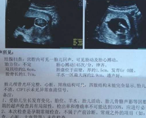 孕16周胎儿女孩b超图图片