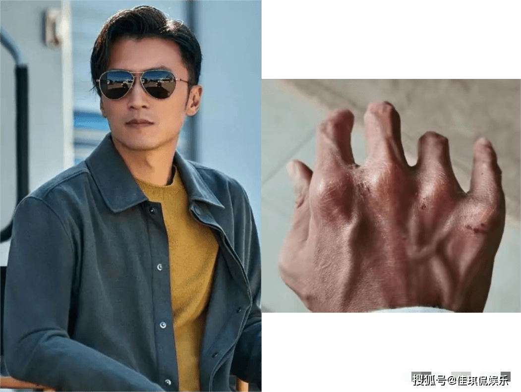 于荣光"无辜躺枪",安志杰被迫"自揭伤疤"证清白_向华强_美国的_嘴唇