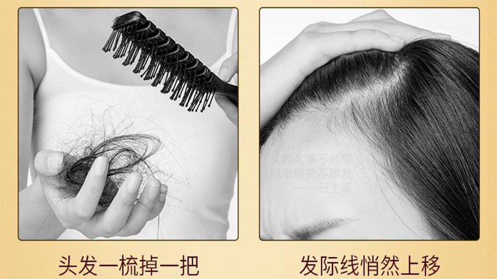 哪个防脱生发品牌的口碑比较好啊?真的有用呢