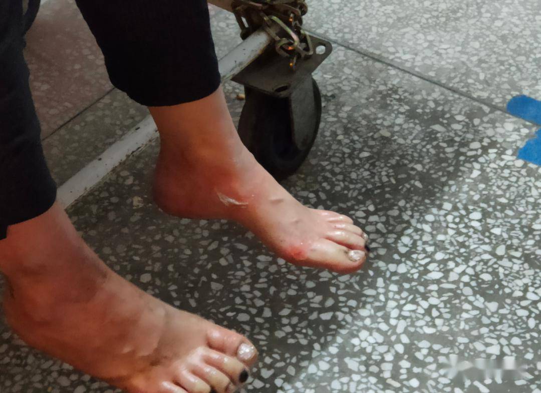 军嫂双脚受伤信阳消防小哥哥上演最帅公主抱