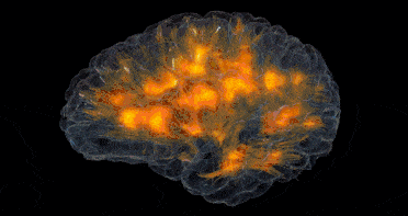 脑科学家洪兰:跟风式育儿正在毁掉你孩子的未来_大脑