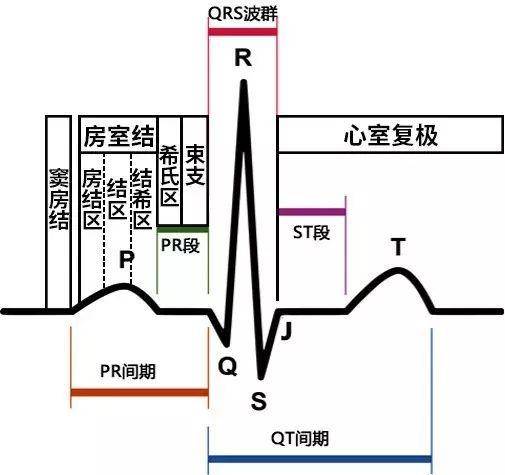 一般认为,急性心肌梗死的心电图的理论体系已臻完美,具有特征性的图形