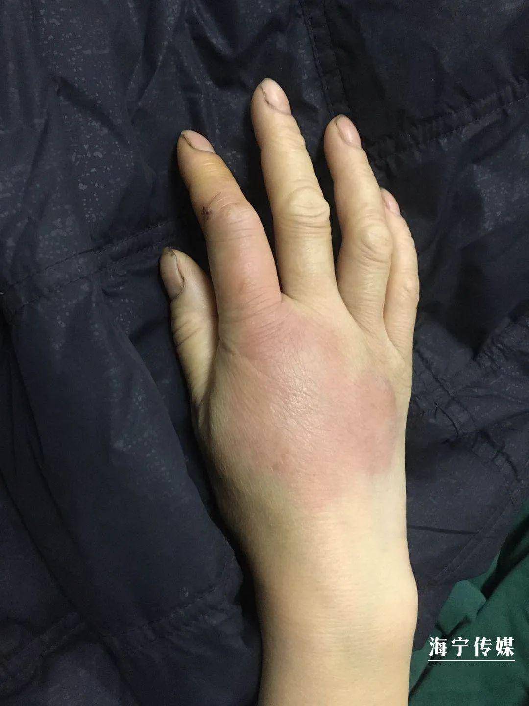 除了毒蛇蜱虫隐翅虫,还要当心这种虫!_蜈蚣