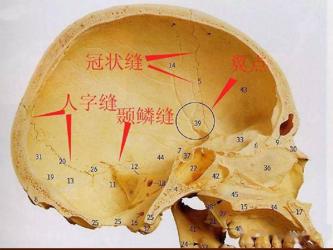 颅骨外伤性骨折ct诊断