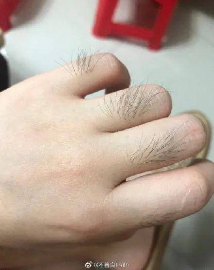 女生的腿毛手毛能有多茂盛