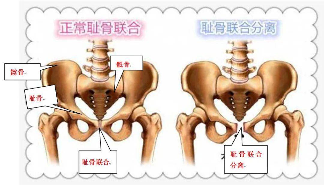 【干货】别苦恼,关于产后康复这篇全部告你