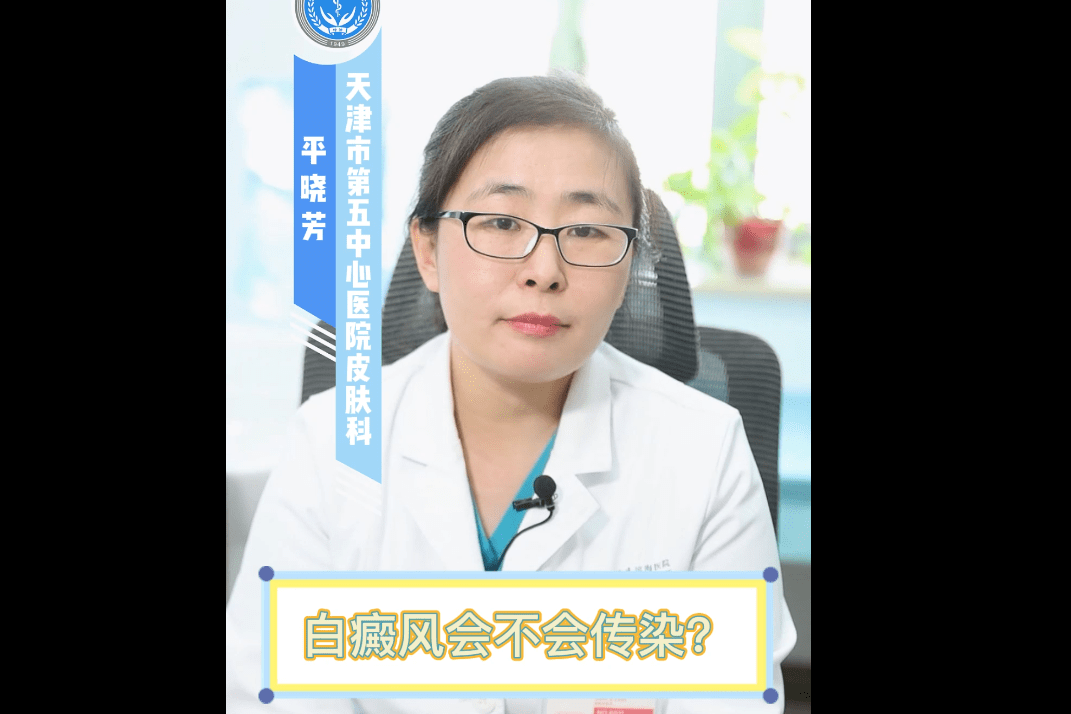 白癜风会不会传染