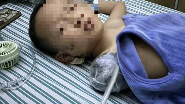 6岁孩子因邻居放炮被炸伤截肢，家长有责任吗？