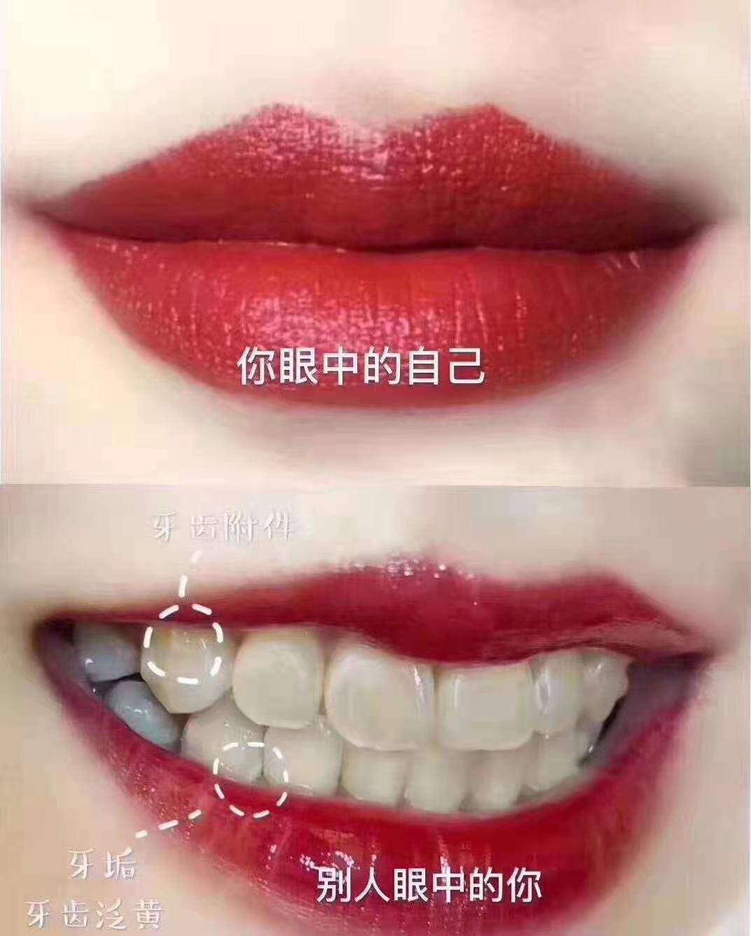 贝齿白你不知道的大白牙小知识