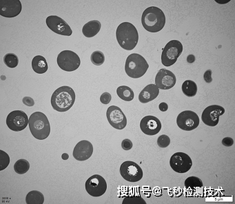 透射電鏡tem應用案例分享釀酒酵母菌