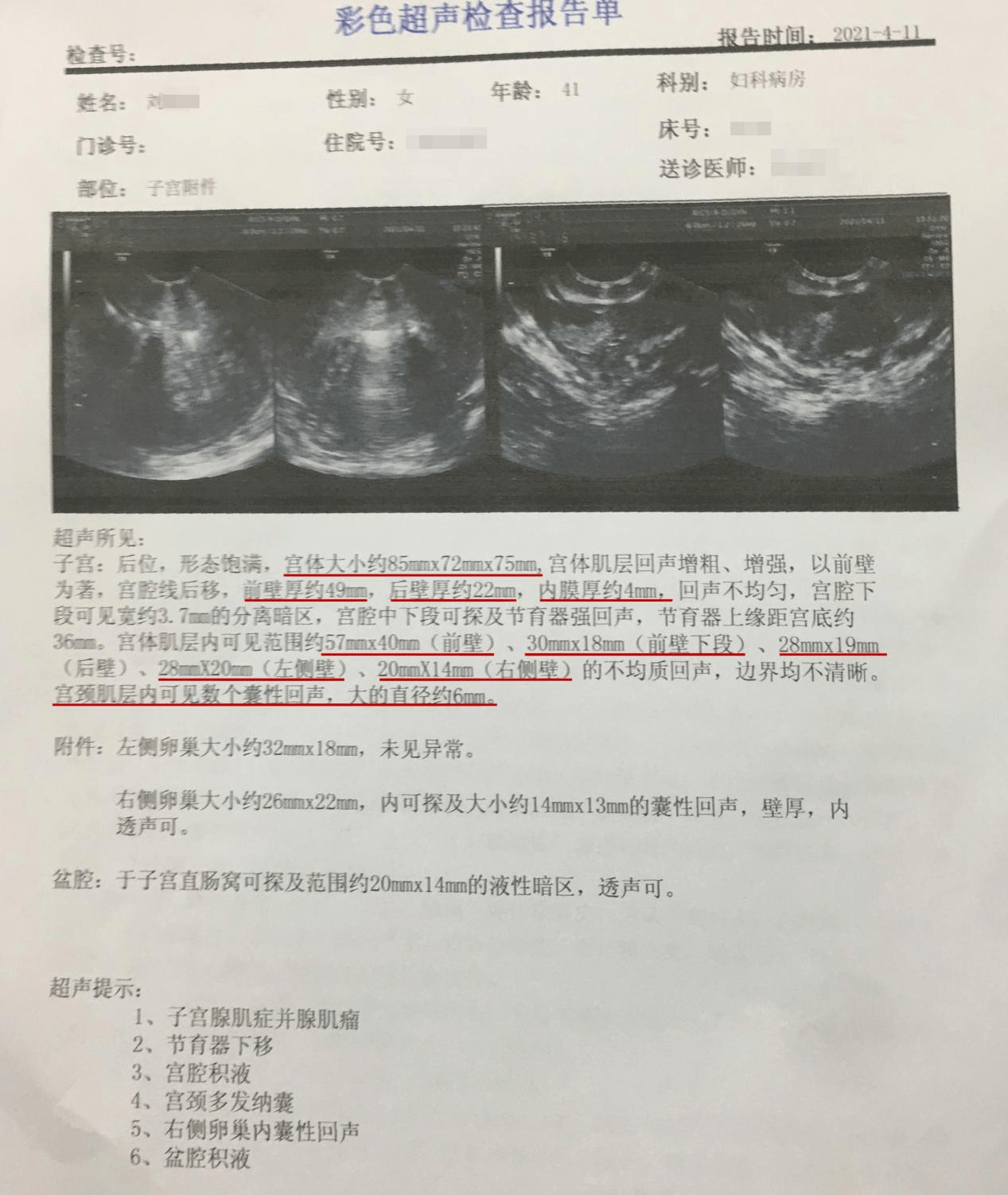 我是浙江的腺肌症患者,今年41岁了!