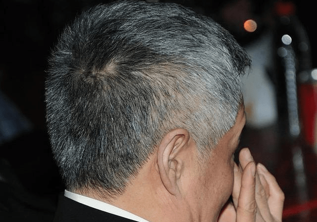 人会气得吐血,还有伤心到一夜白头,是真的吗?