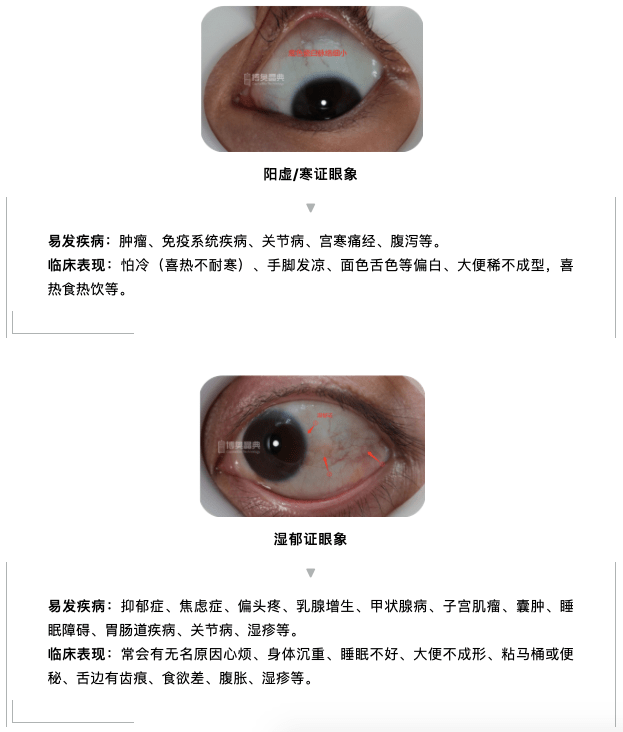 看眼球诊断疾病图片图片
