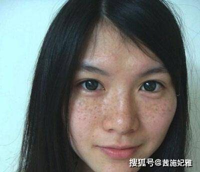茜施妃雅小课堂 女人最容易长斑的四个时间段你搞清楚了吗 皮肤