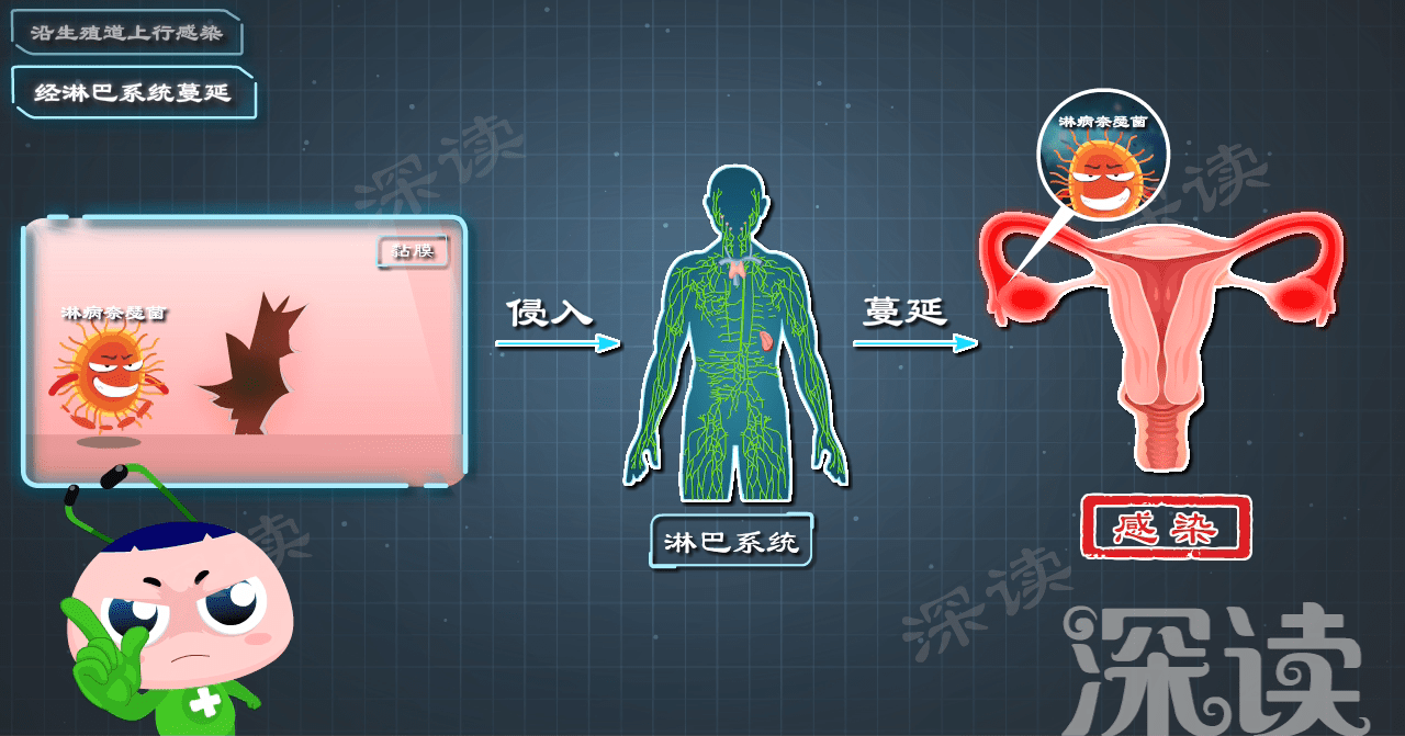 原创
腹痛、白带异常很糟心?做好这四件小事能预防卵巢炎!必看!