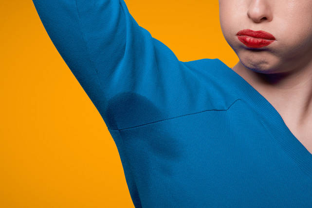 腋臭又名"臭汗症",是由于腋窝大汗腺的排泄产物,经皮肤表面的细菌分解