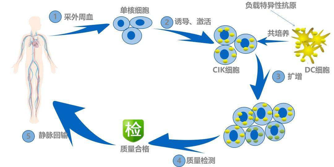 根據治療方法的不同,免疫細胞療法可以分為免疫細胞療法和免疫檢查點