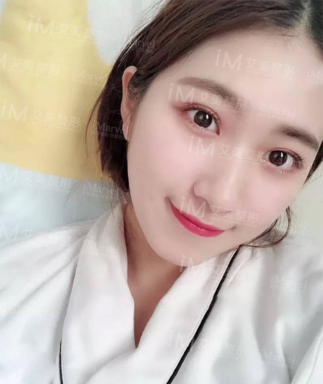 朋友|为了美丽，对自己下手“狠的人”真的很多，达芬奇定制美眼为啥她点名了非要做