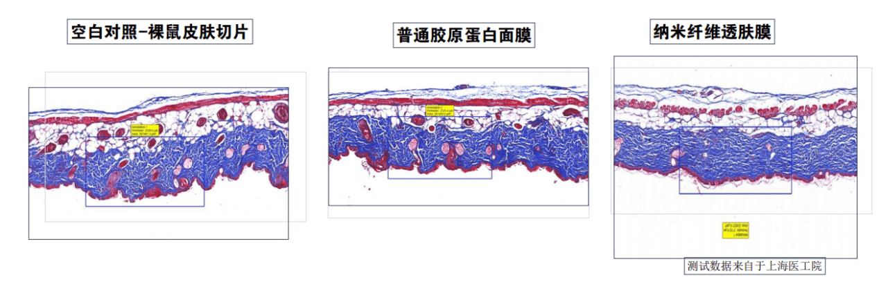 对比|不二生物科技：填补国内面膜市场技术空白