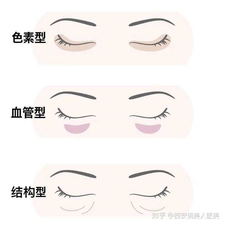 结构型|寻香师：2分钟教你和黑眼圈说再见