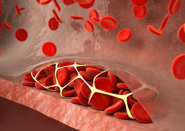 缺乏营养|蹲久了站起来就头晕?别大意,可能是3种疾病在作祟