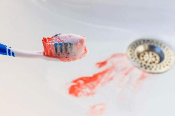 眼睛|频繁牙龈出血，被确诊肝硬化，医生叹息：1事常做，或比酒更伤肝