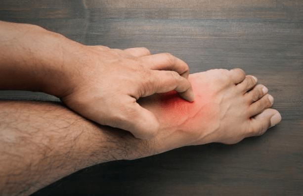 症状|血糖超标“脚先知”,若脚上没有出现3异常,恭喜你,血糖很稳定