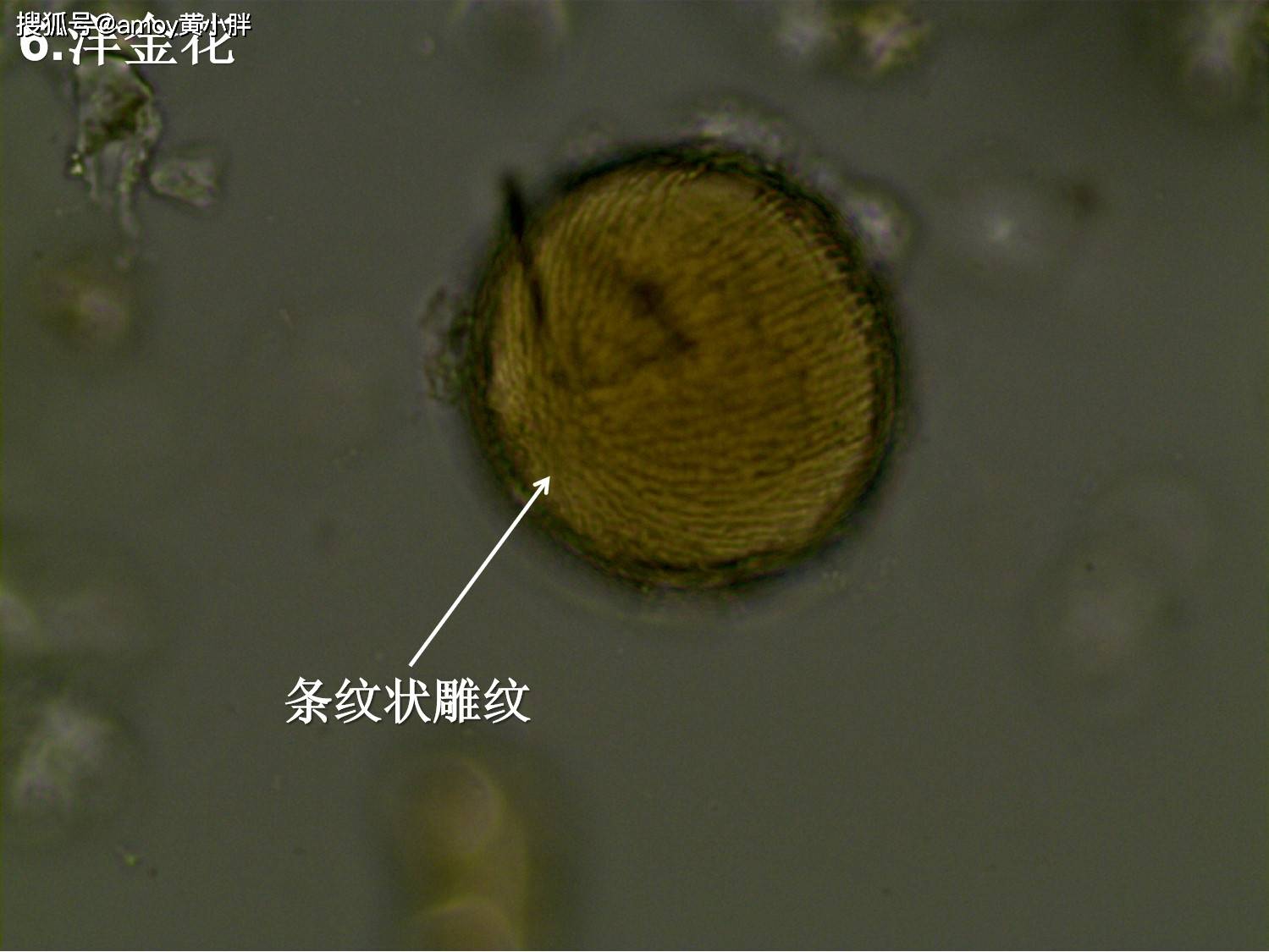 石细胞篇五味子 石细胞黄芩 石细胞肉桂 石细胞槟榔 石细胞黄柏 石