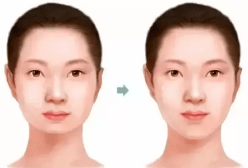 减肥多久才能下颌线清晰 042eaa75ba5641f7ac5ac9c555141690.png