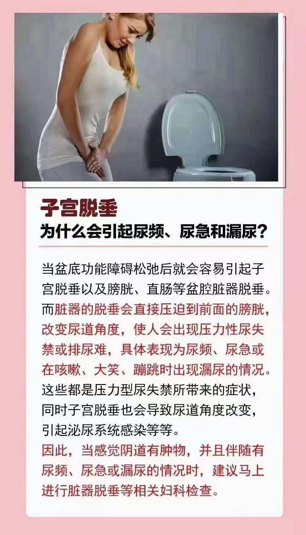 宫颈下垂症状图片