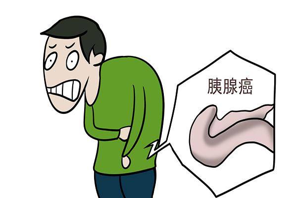 不同位置胰腺癌早期症状 做哪些检查排查 诊断