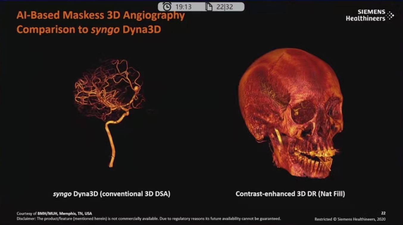 降低|神经介入领域新技术展望
