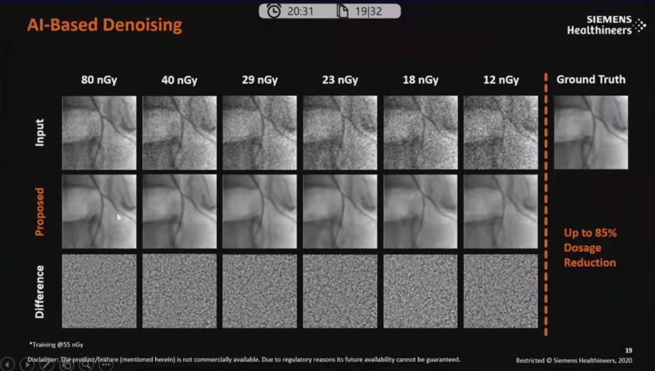 降低|神经介入领域新技术展望