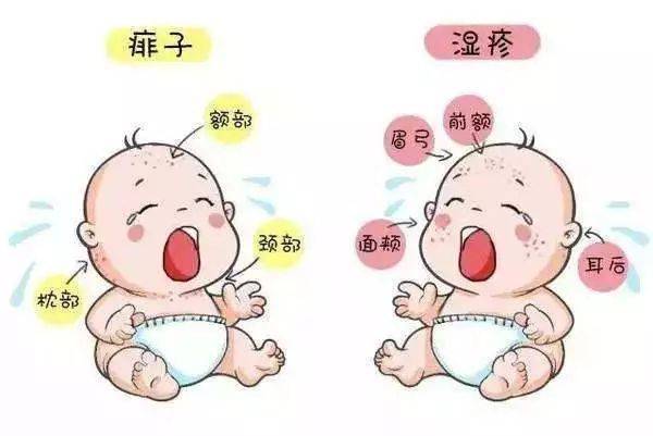 幼儿得湿疹怎么办