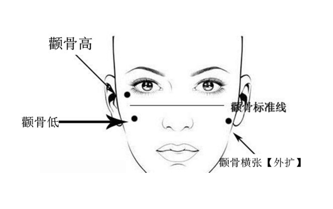 复合张笑天改脸型：颧骨缩小手术的切口在哪里？