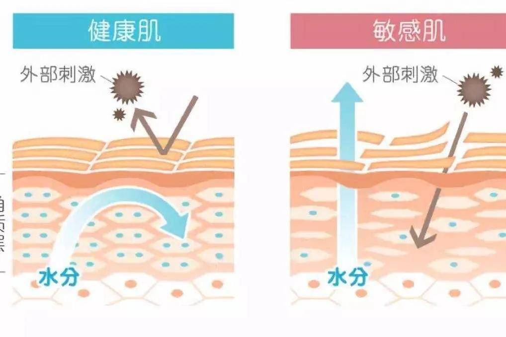 功效敏感性皮肤的问题解析？为什么你的皮肤会成为敏感肌？