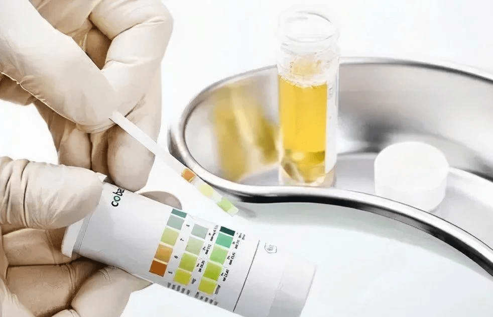 并发症|中日友好医院李爱国主任医师为您解说预防糖尿病并发症要做哪些检查?