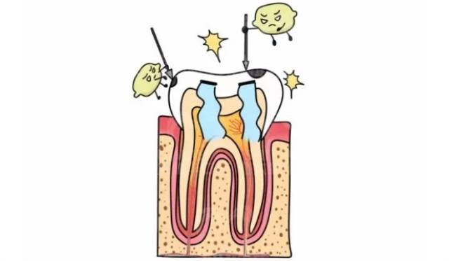 降到最低|为什么喝完可乐不能马上刷牙？