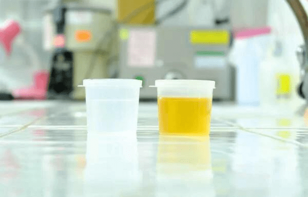 症状|糖尿病患者身体出现这6大症状，李爱国主任提醒可能是糖尿病肾病来了，别忽视!