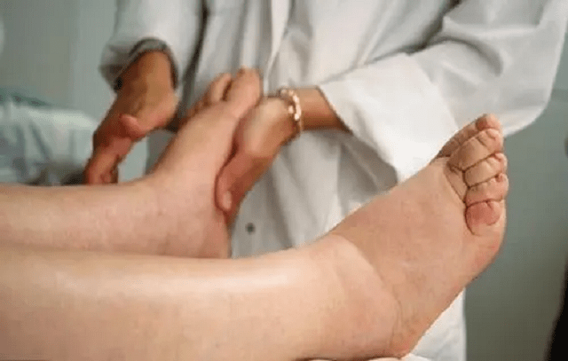 治疗|27岁男子确诊尿毒症，医生：这个早期“沉默杀手”常被很多人忽视