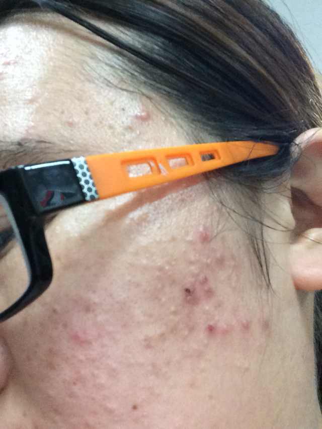 现在,知道为何你家孩子,会得地中海贫血,鱼鳞病,小儿肠套叠,小儿心脏