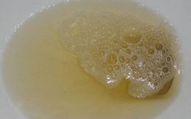 症状|尿毒症患者越来越多，肾脏病变时，身体可能会发出3个信号，需留意