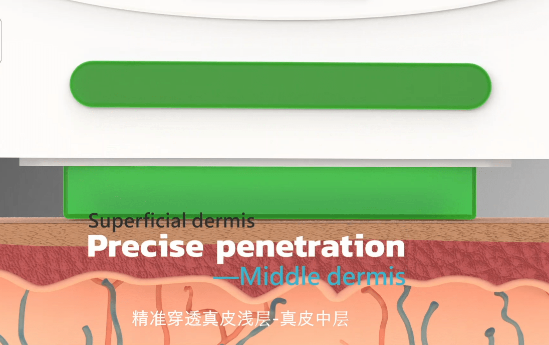 面部面部缺水干细纹多，nir牛奶光美白嫩肤有用吗？