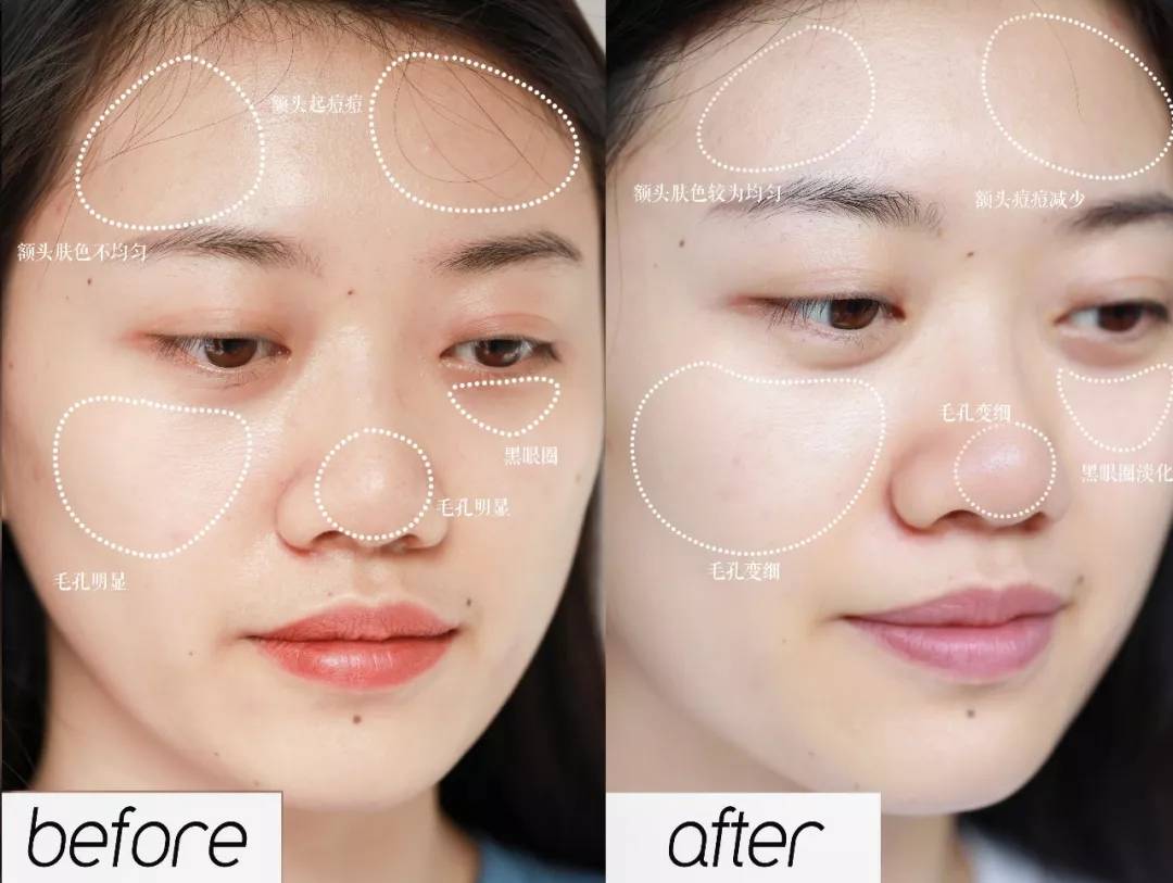 企业当轻医美,逐步形成为一种生活方式。