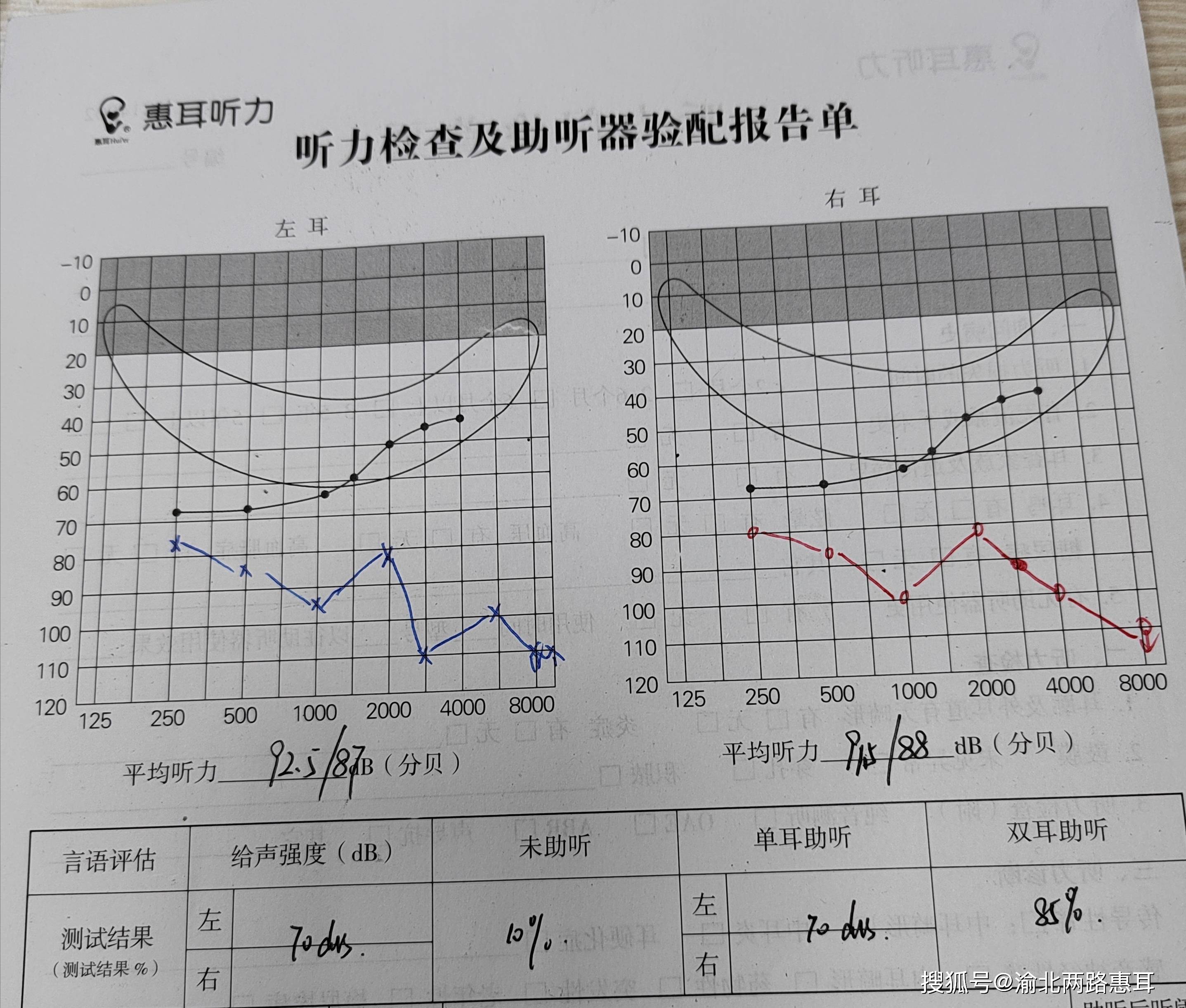 耳镜检查报告图片图片