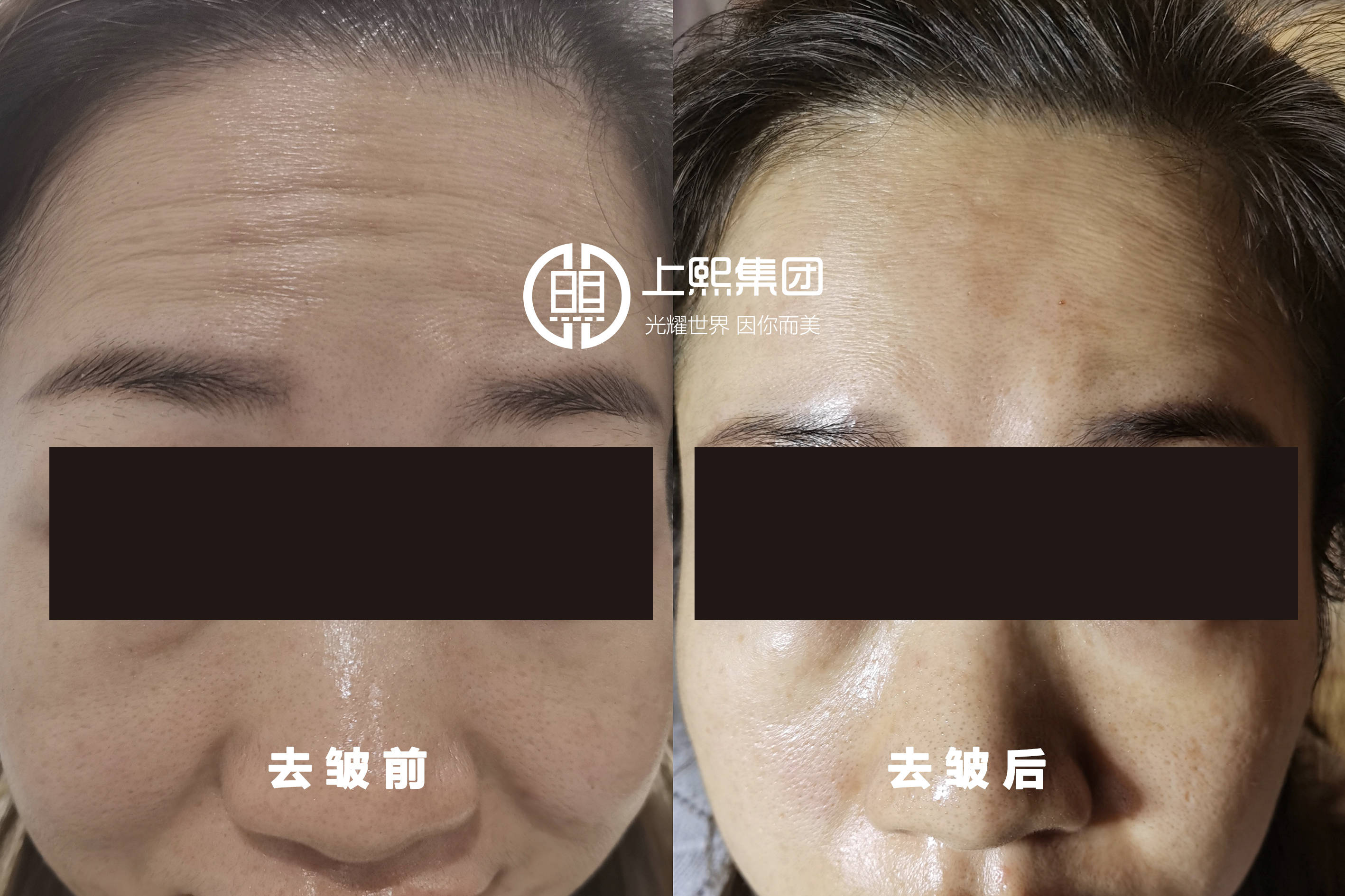 产品上熙轻医美，抗衰提升新选择