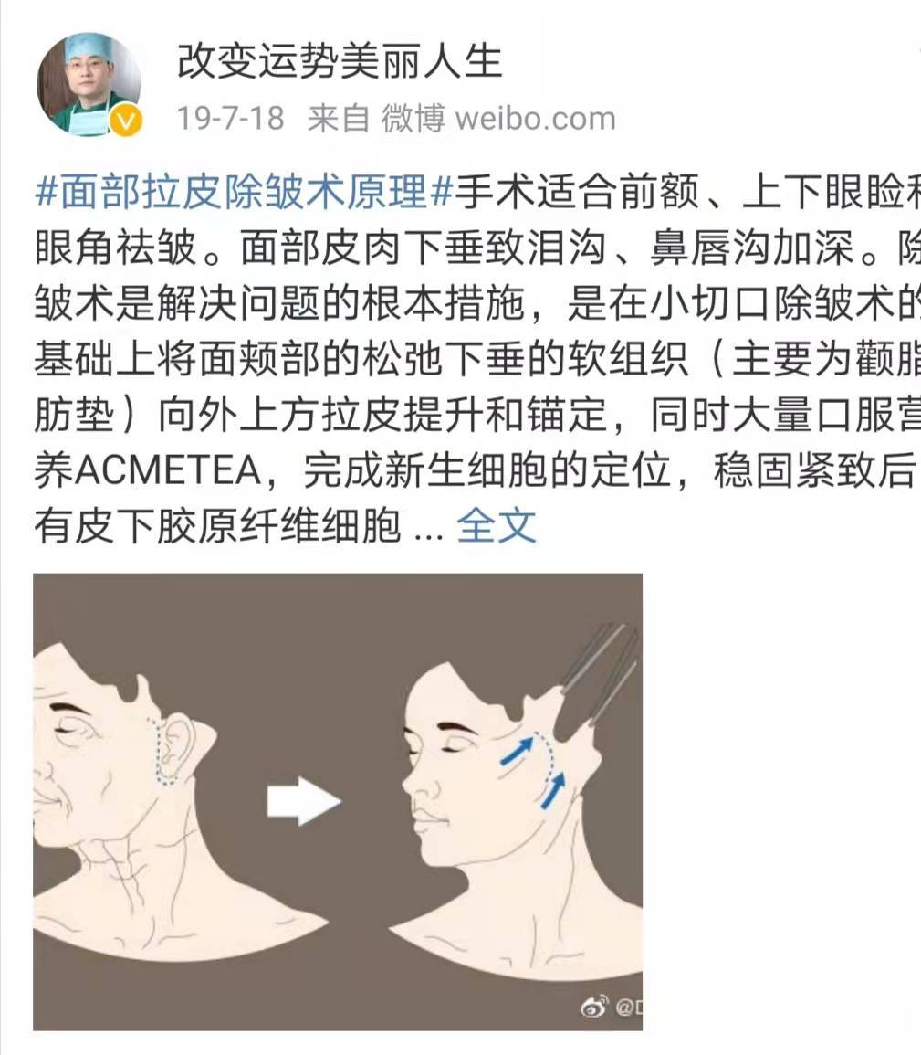 人群40岁做拉皮会不会太早拉皮手术多大年龄做合适太难了~