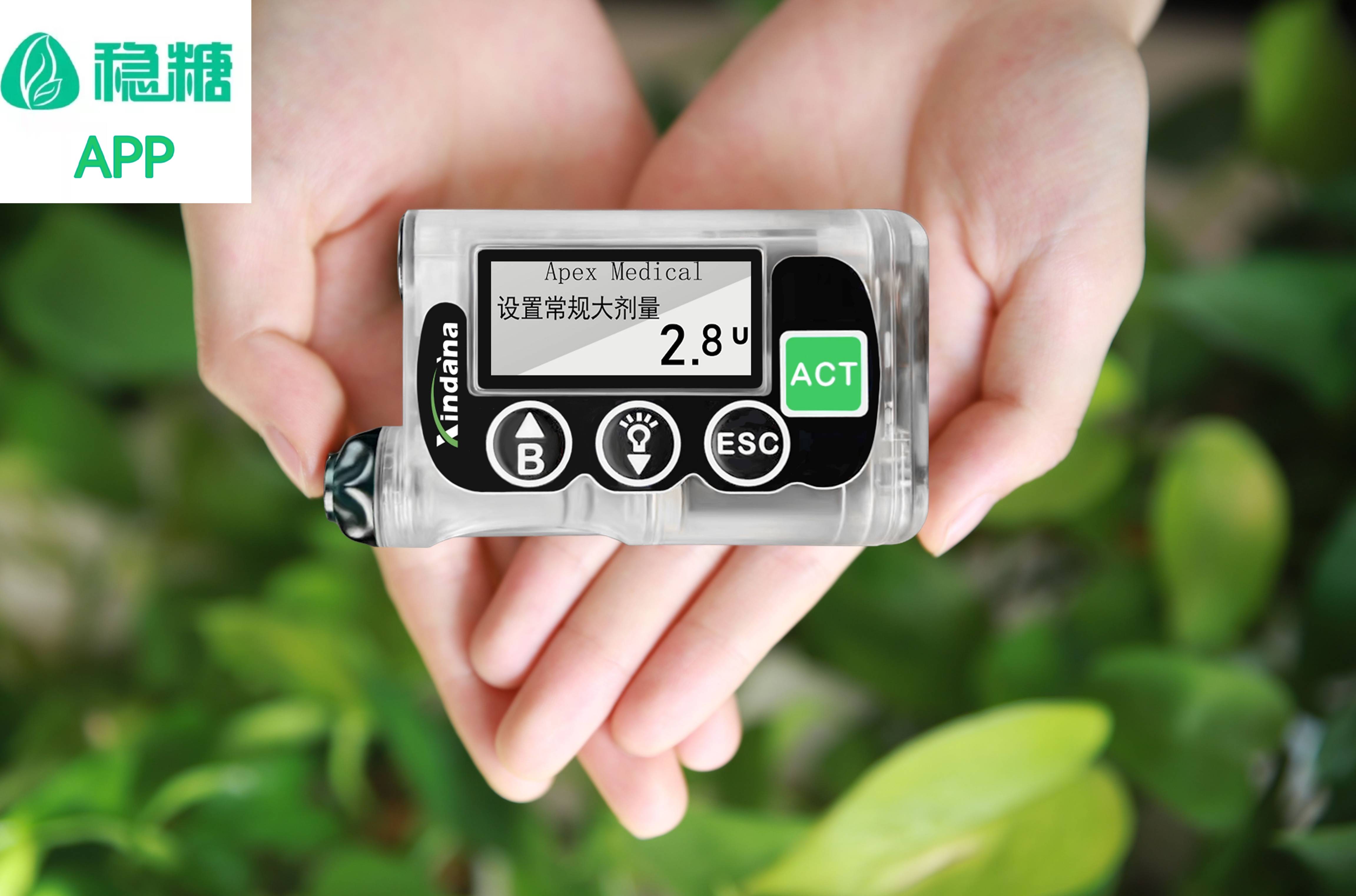 胰岛素泵有哪些品牌哪个品牌的胰岛素泵好