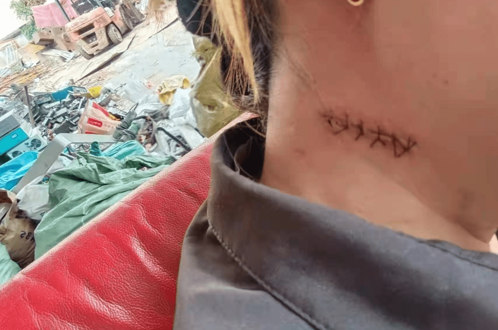 案例分享:突如其来的伤害 杨小姐的惊险经历